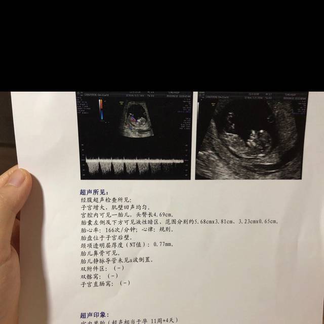 借卵试管婴儿的标准是什么