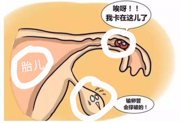 借卵试管移植失败后多久来月经