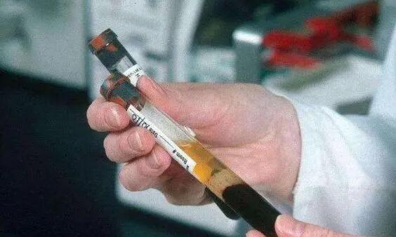 广西南宁做借卵试管的医院排名