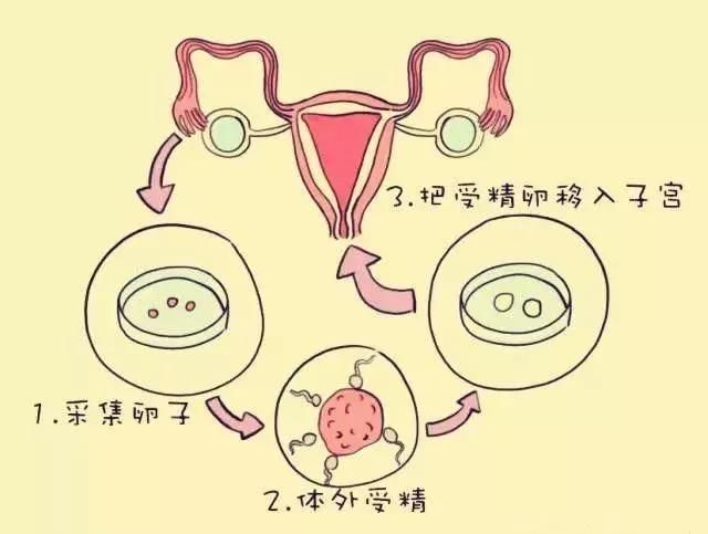 女孩子和女孩子试管是什么