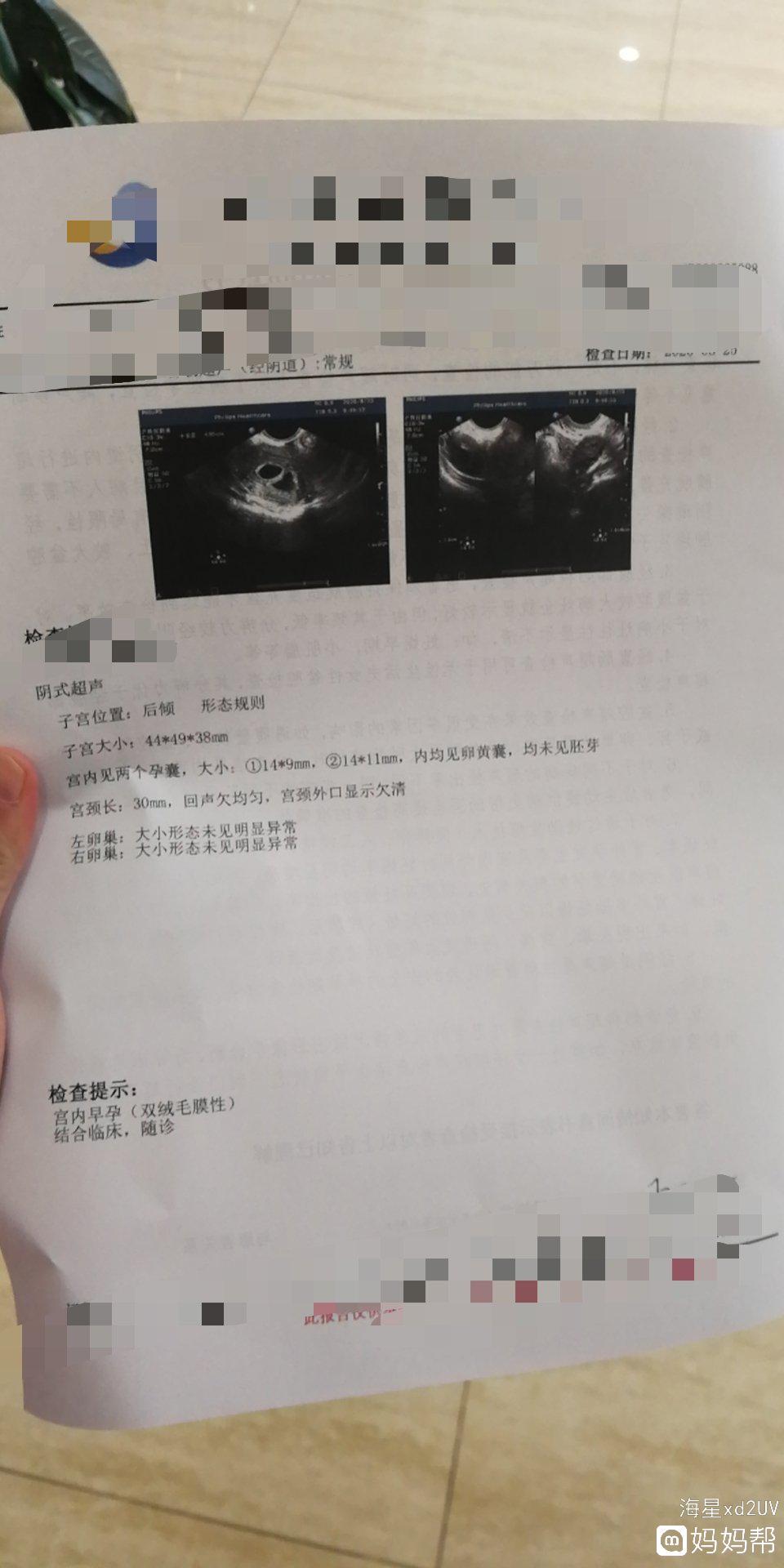 广西医学院试管婴儿需要多久