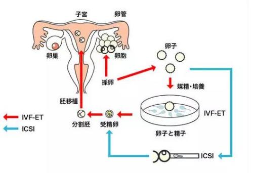 南宁二代代怀生子私立医院做得最好的生殖医院是哪家？