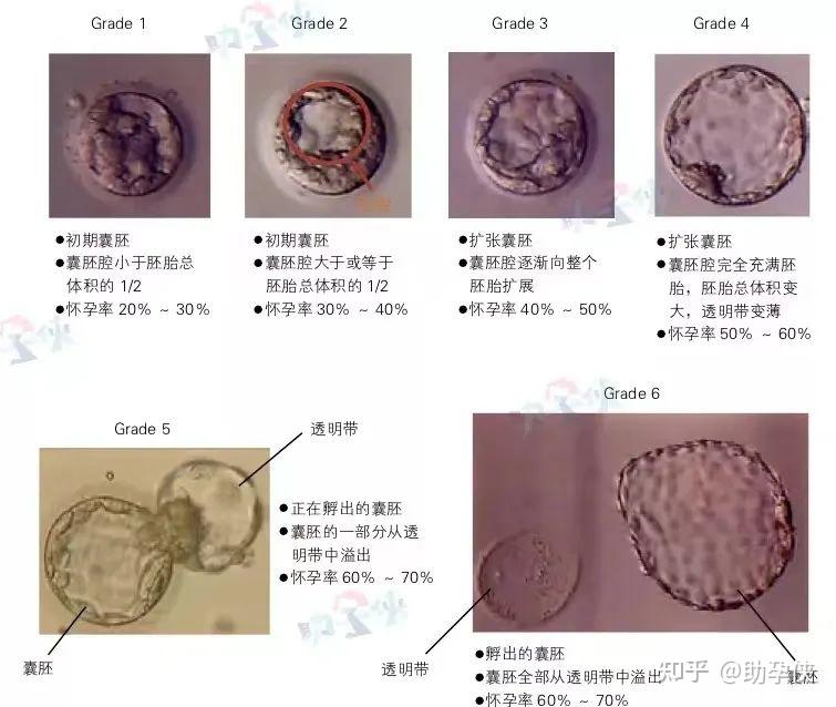 2个生女儿偏方试试就知道准不准